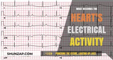 Heart's Electrical Activity: Understanding the ECG's Role