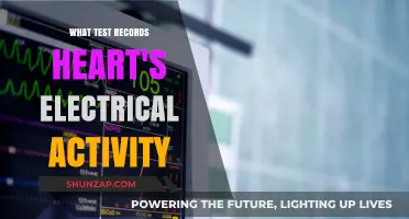 Heart's Electrical Activity: Understanding the ECG Test