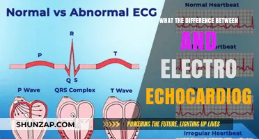 Electrocardiogram vs Echocardiogram: What's the Difference?