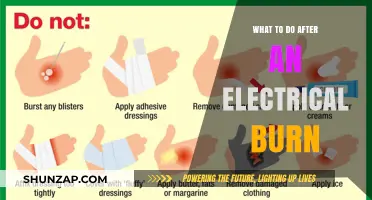 Electrical Burns: Immediate Steps to Take After an Injury