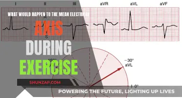 Electrical Axis Shift: Exercise Impact on Heart's Electrical Axis