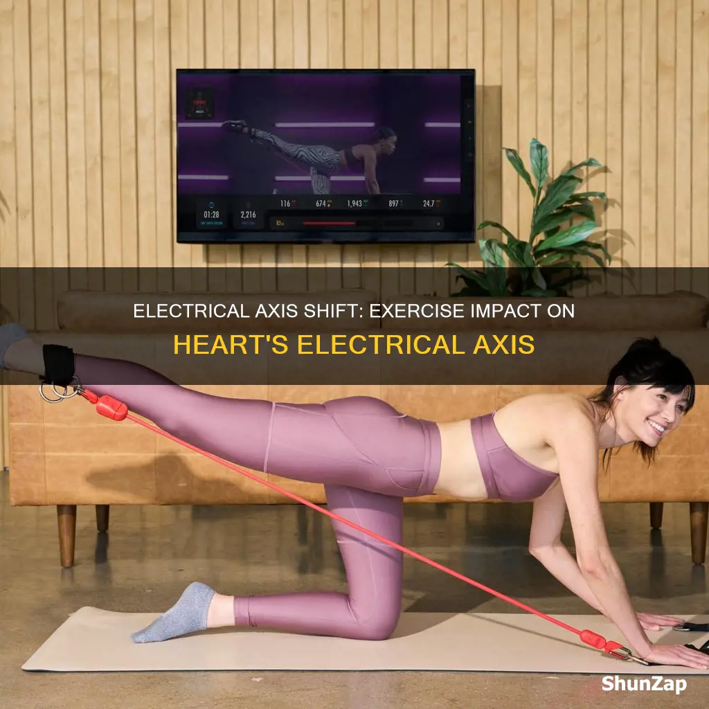 what would happen to the mean electrical axis during exercise
