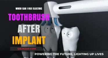 Post-Implant Oral Care: When to Safely Use an Electric Toothbrush