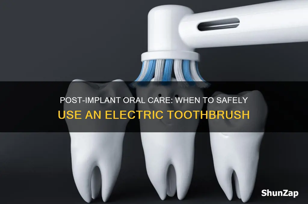 when can i use electric toothbrush after implant