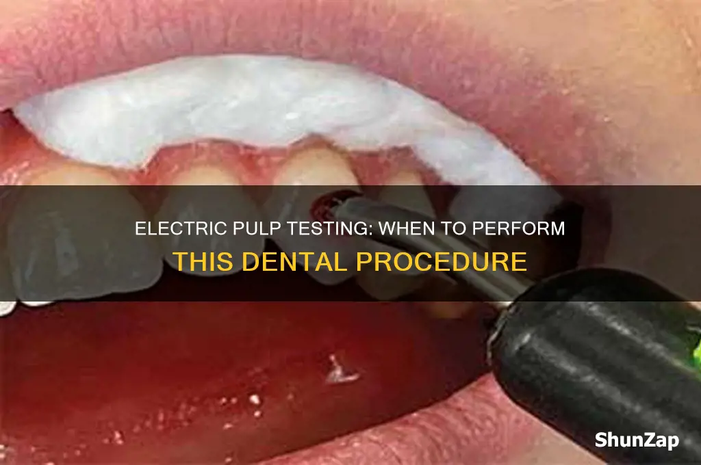 when do you perform electric pulp test