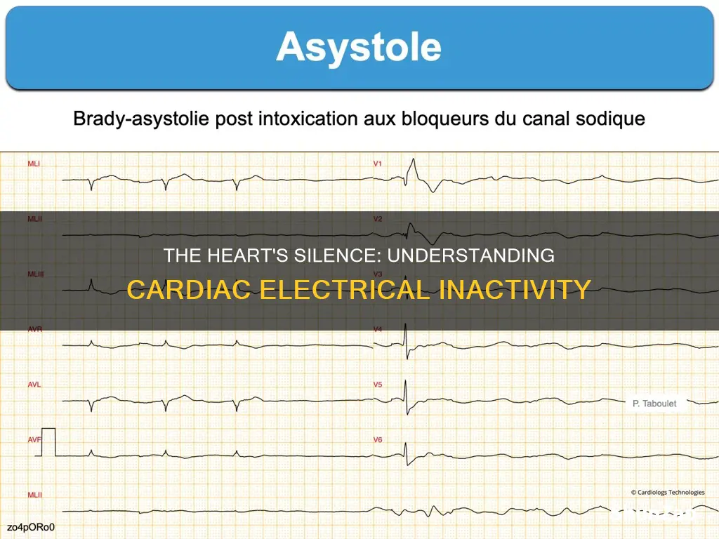 when there is no cardiac electrical activity