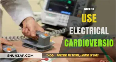 Electrical Cardioversion: Timing and Indications for Effective Heart Rhythm Restoration
