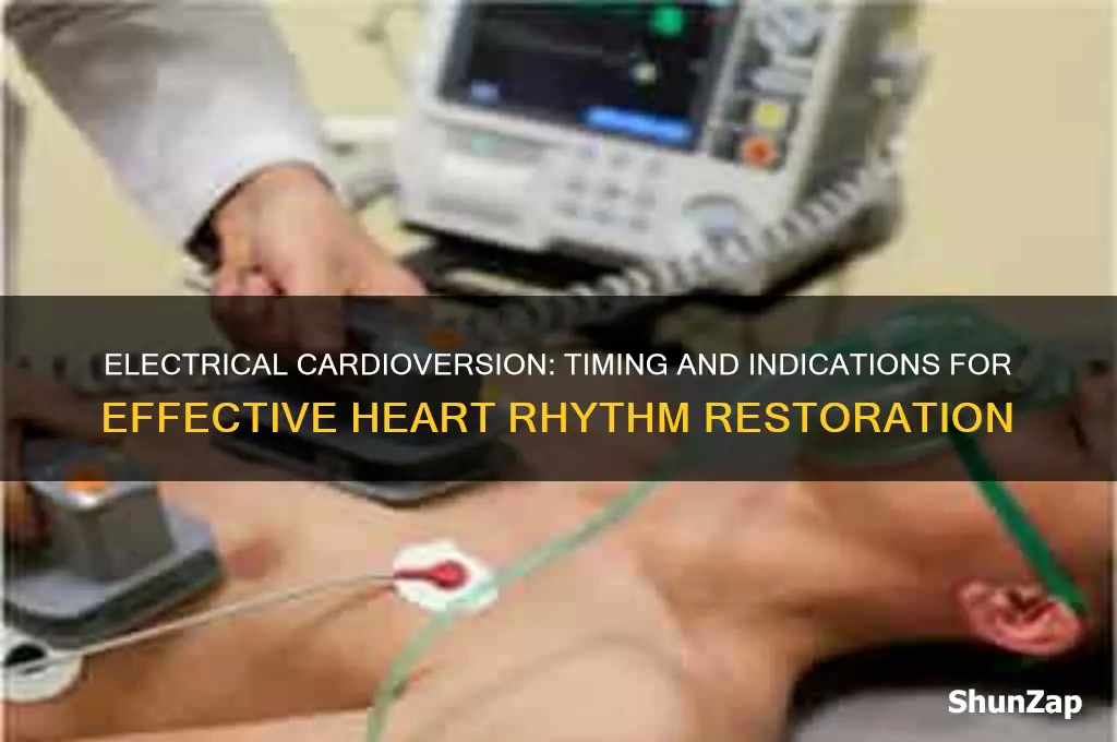 when to use electrical cardioversion