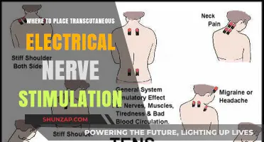 Best Placement for Transcutaneous Electrical Nerve Stimulation Therapy