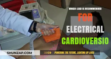 Choosing the Right Lead for Electrical Cardioversion