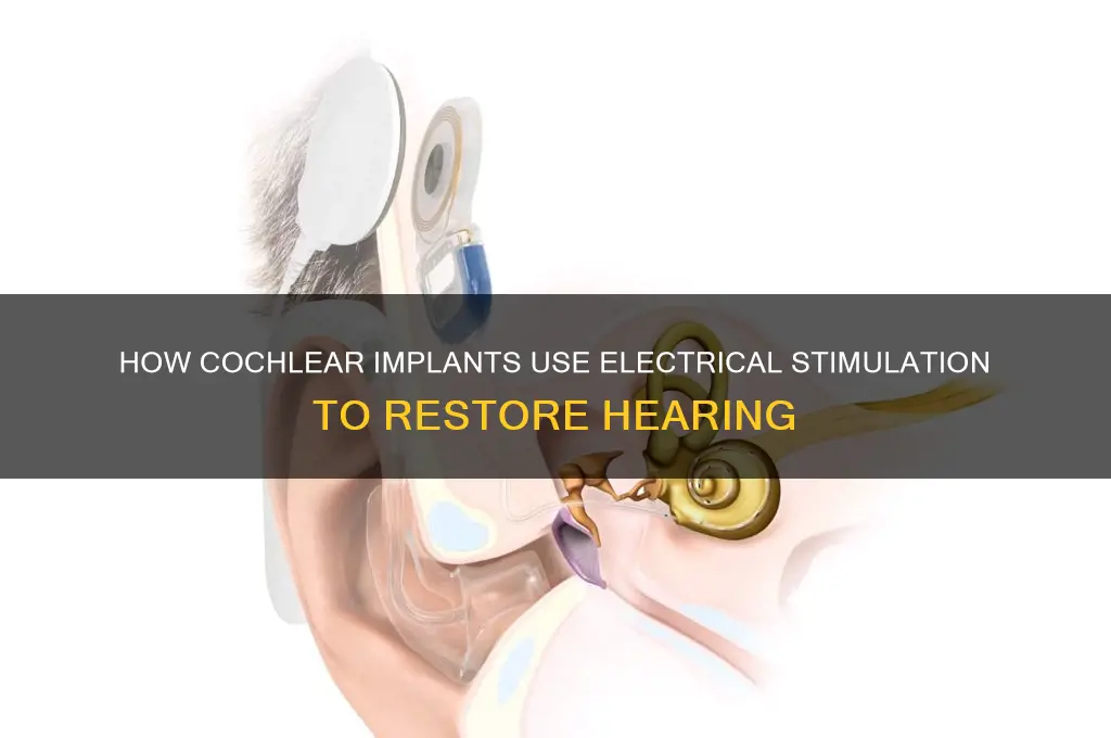 which listening device uses electrical stimulation of a nerve
