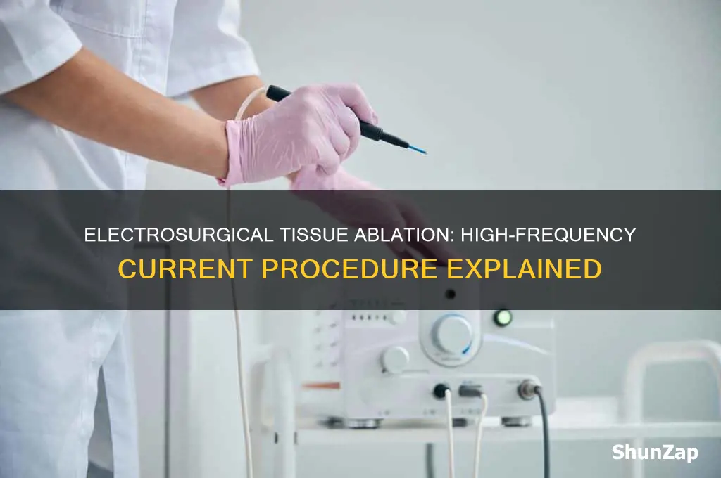 which procedure destroys tissue using a high-frequency electric curren