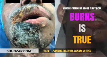 Electrical Burns: What's the Truth?