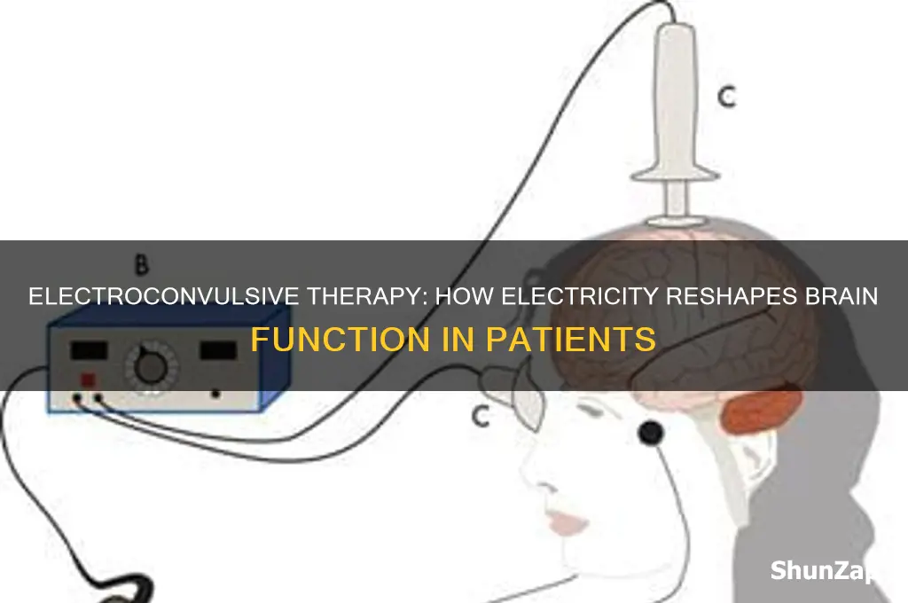 which therapy use electricity to affect a patients brain
