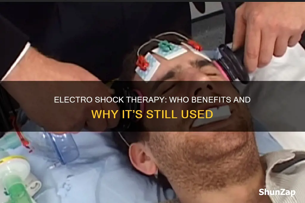 who uses electro shock therapy