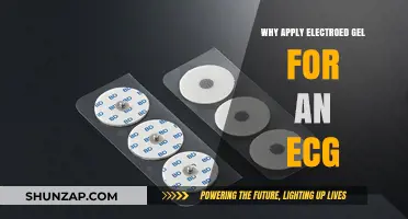 Electrode Gel: Why It's Essential for ECG Accuracy