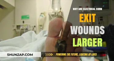Electrical Burns: Exit Wounds Enlarged by Current