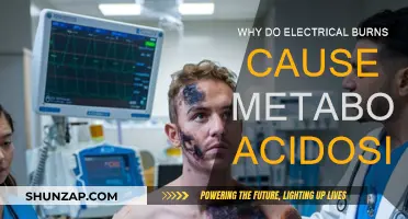 Electrical Burns: Metabolic Acidosis and Its Causes
