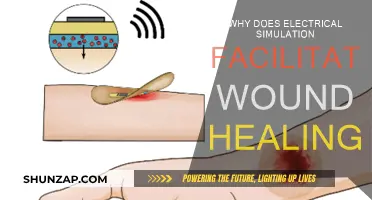 Electrical Simulation: Healing Wounds, Facilitating Recovery