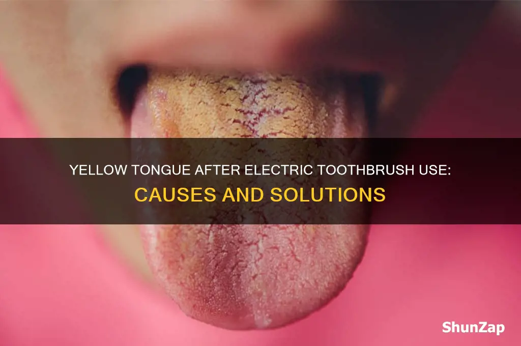 why is my tongue yellowish after using electric toothbrush