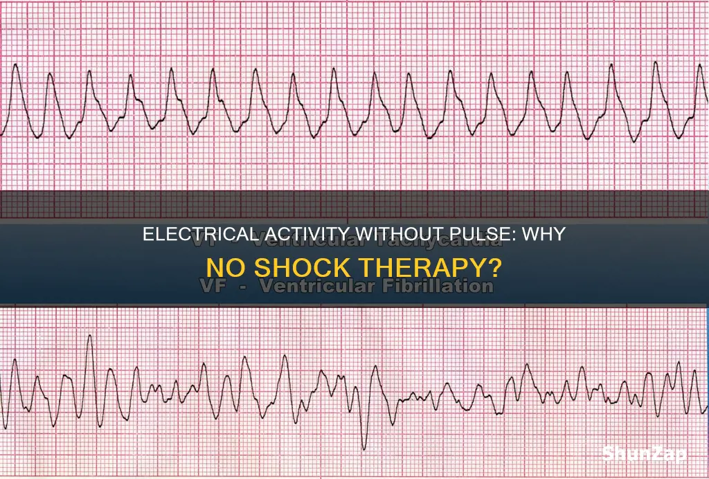 why is pulseless electrical activity not shockable