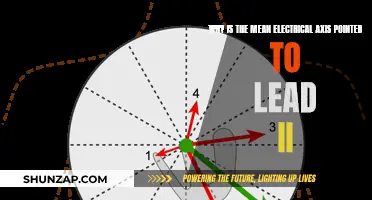 Electrical Axis: Lead II's Unique Perspective
