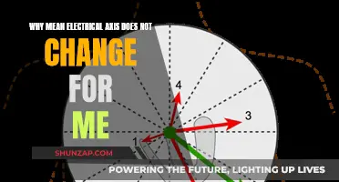 Electrical Axis: Why It Stays the Same for Me