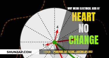 Electrical Axis of the Heart: Unchanging Mean, Unyielding Mystery