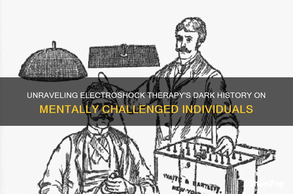 why was electro shock therapy used on mentally challanged people